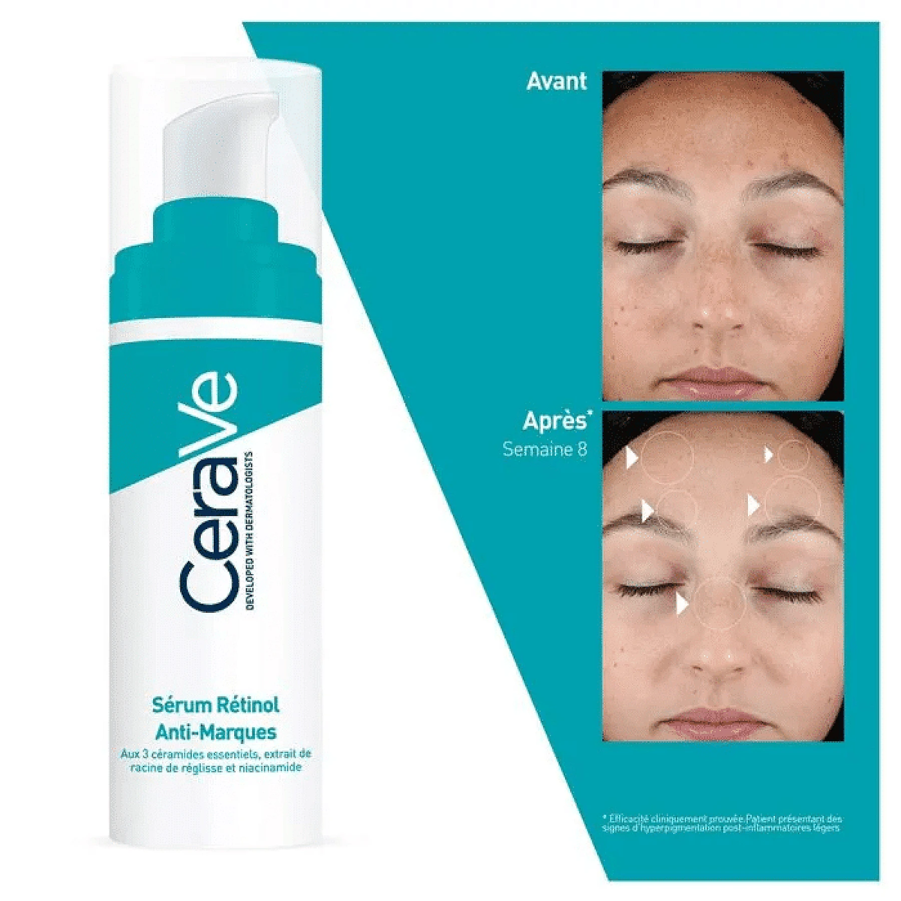 CeraVe Sérum Rétinol Anti-Imperfections Peaux à Imperfections 30 ml – CERAVE 30ML