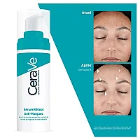 CeraVe Sérum Rétinol Anti-Imperfections Peaux à Imperfections 30 ml