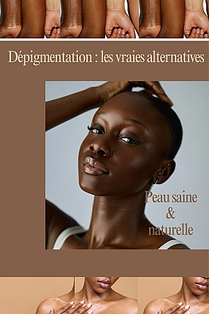 Les dangers de la dépigmentation : les vraies alternatives pour une peau belle